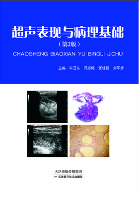 超声表现与病理基础