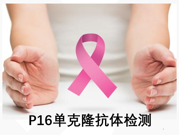 宫颈癌早期筛查—p16单克隆抗体检测