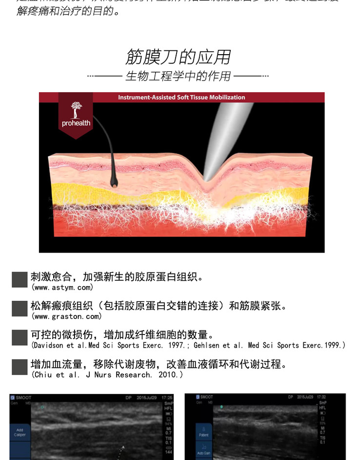 athlax iastm肌筋膜刀理疗工具筋膜刀松解刀软组织辅助松解技术