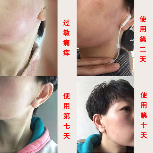 请进新店购买+客服微信1893467129玉肌散面膜粉|紧致上提 纯中药粉 道医秘方|任何肤质包括过敏性皮肤 商品图2