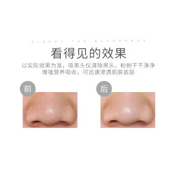 nerf 孚素FUSOU洁面仪电动美容仪洗脸仪家用洗脸去黑头毛孔清洁器 白色 商品图4