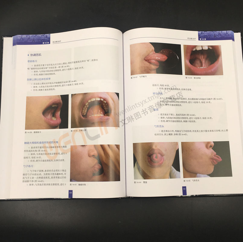 trainer与myobrace训练器及生物功能托槽的临床应用 史真 路正刚主译