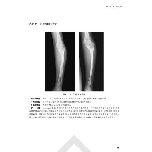 X线读片指南（第4版）    精装开本 商品图2
