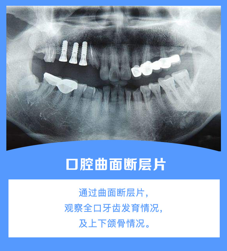 测试用,不发货!口腔曲面断层片