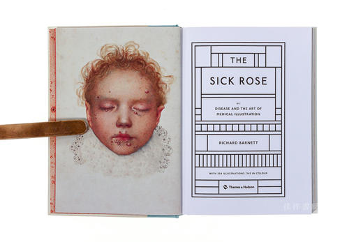 The Sick Rose: or; Disease and the Art of Medical Illustration 病态的玫瑰：疾病与医学 商品图2