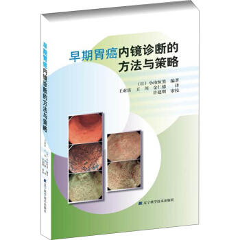  早期胃癌内镜诊断的方法与策略  商品图0