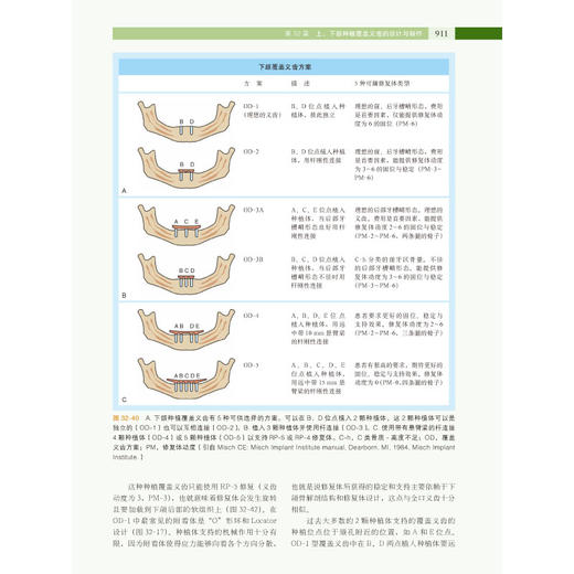 口腔种植修复学下卷 商品图6