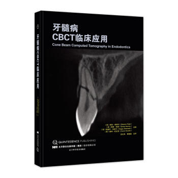 《牙髓病CBCT临床应用》 商品图0