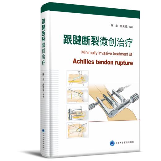 跟腱断裂微创治疗 陈华 唐佩福 北医社 商品图0
