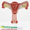 现货速发【医教模型】颐诺人体医学女性子宫模型卵巢生殖结构解剖模型妇科妇产科 商品缩略图1