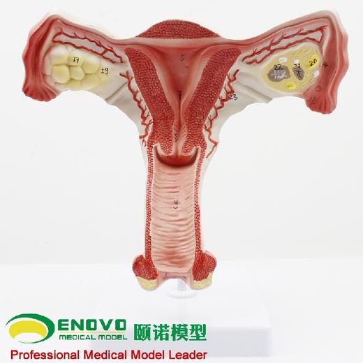 现货速发【医教模型】颐诺人体医学女性子宫模型卵巢生殖结构解剖模型妇科妇产科 商品图1