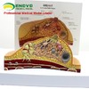 现货速发【医教模型】ENOVO颐诺乳房病理解剖模型乳房模型 商品缩略图2