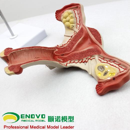 现货速发【医教模型】颐诺人体医学女性子宫模型卵巢生殖结构解剖模型妇科妇产科 商品图0