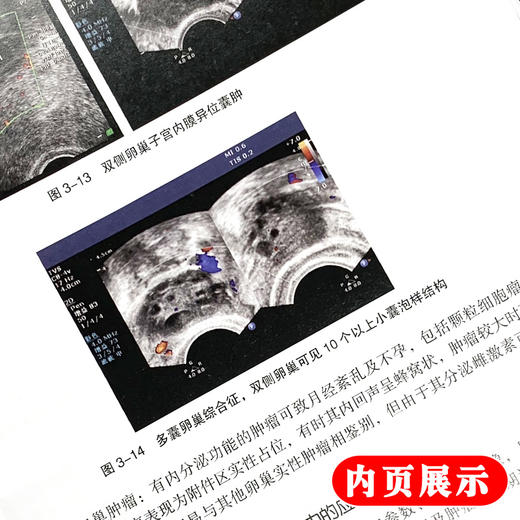 月经异常 陈子江主编 人民卫生出版社 妇科 9787117282574 2019年3月参考书 商品图3