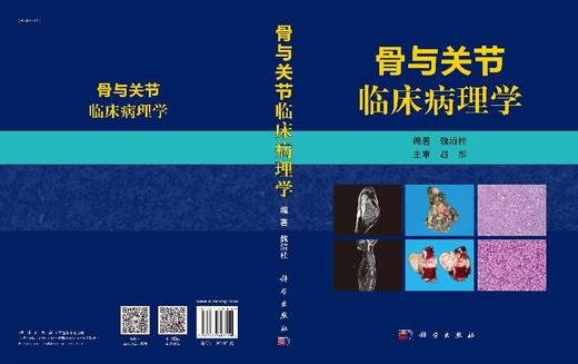 骨与关节临床病理学 商品图3