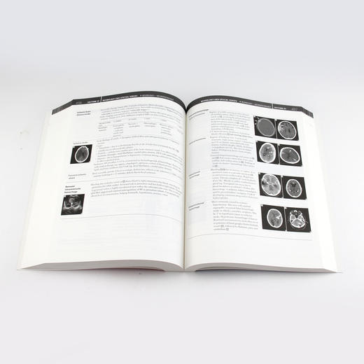 USMLE Step 1 考试指导（第28版）（英文版） 商品图2