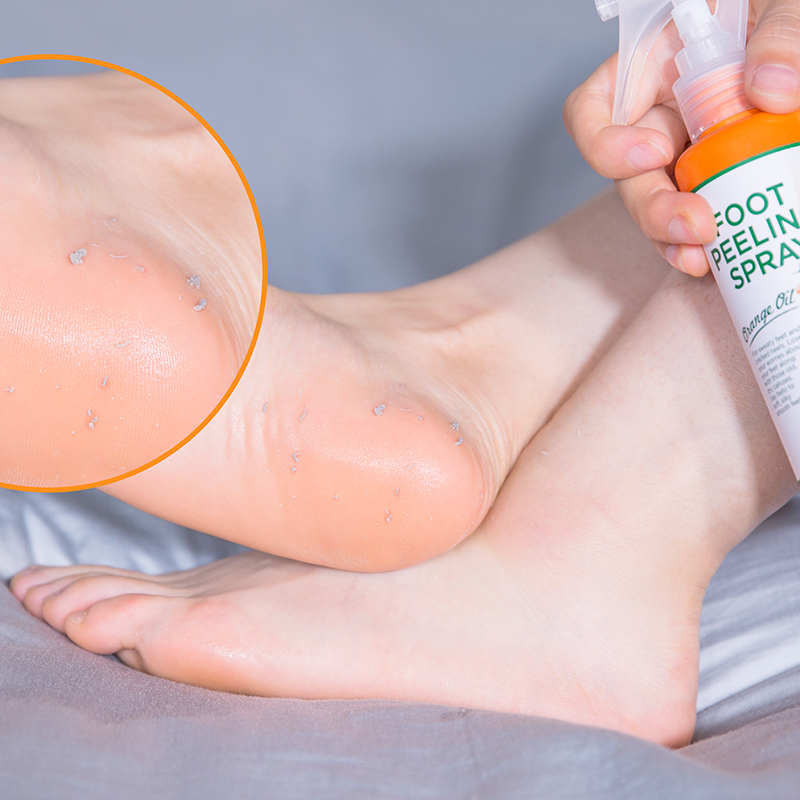 【喷一喷 脚丫子滑嫩嫩哒~】日本foot medi足部祛角质