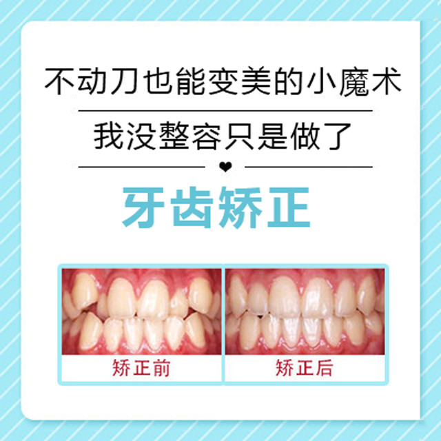 【牙齿矫正】正牙美脸 改变脸型 金属/陶瓷/矫正龅牙,歪牙,牙不齐