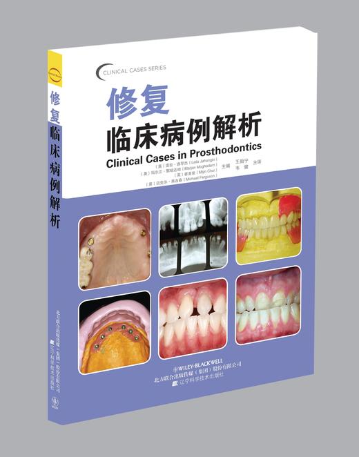 《修复临床病例解析》 商品图0