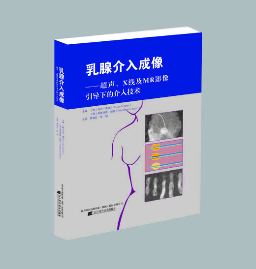 《乳腺介入成像——超声、X线及MRI影像引导下的介入技术》 商品图0