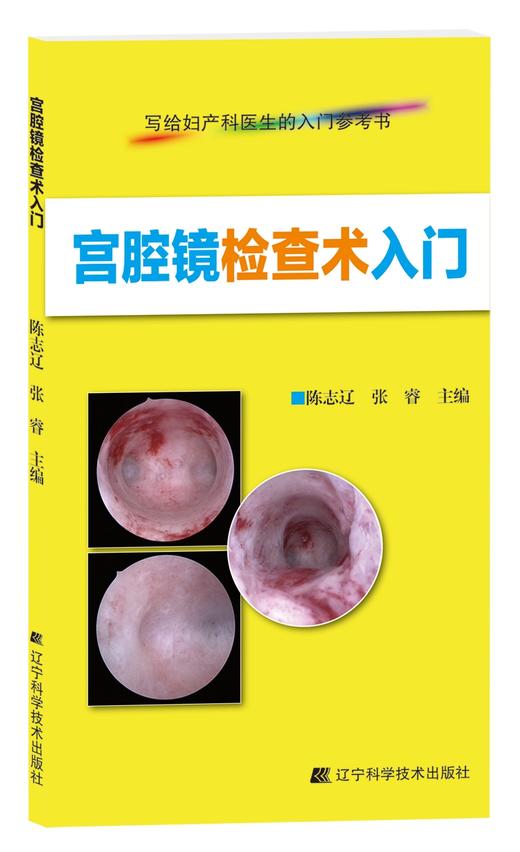 《宫腔镜检查术入门》 商品图0
