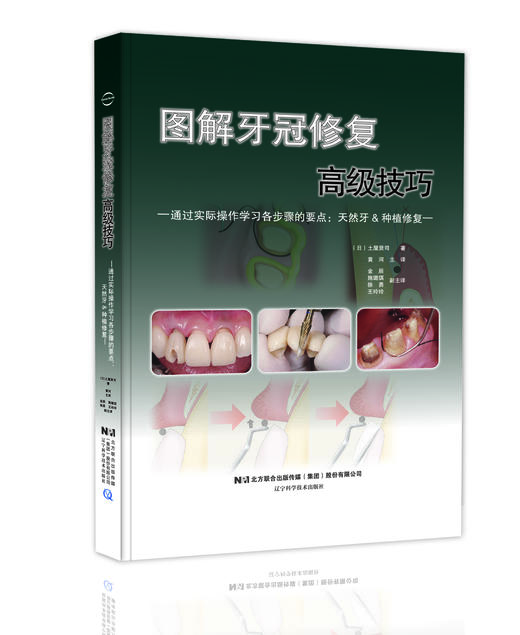 《图解牙冠高级修复技巧》 商品图0