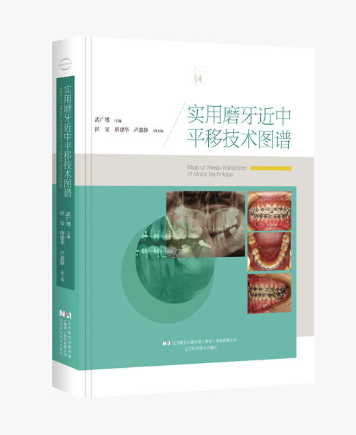 《实用磨牙近中平移技术图谱》 商品图0