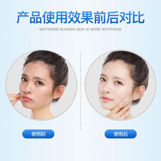 IMAGES/形象美玻尿酸面膜补水保湿提亮肤色收缩毛孔正品专用男女士送美白面膜30片 商品图3