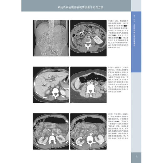 《消化影像诊断学（原著第3版）》—— “国际经典影像诊断学丛书” 商品图4
