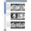 《消化影像诊断学（原著第3版）》—— “国际经典影像诊断学丛书” 商品缩略图3