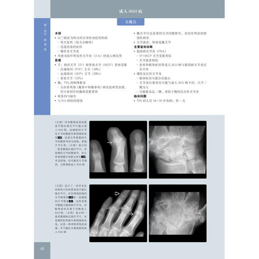 《骨肌影像诊断学（非创伤性疾病）（原著第 2 版）》——国际经典影像诊断学丛书 商品图3