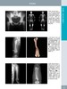 《骨肌影像诊断学（非创伤性疾病）（原著第 2 版）》——国际经典影像诊断学丛书 商品缩略图2