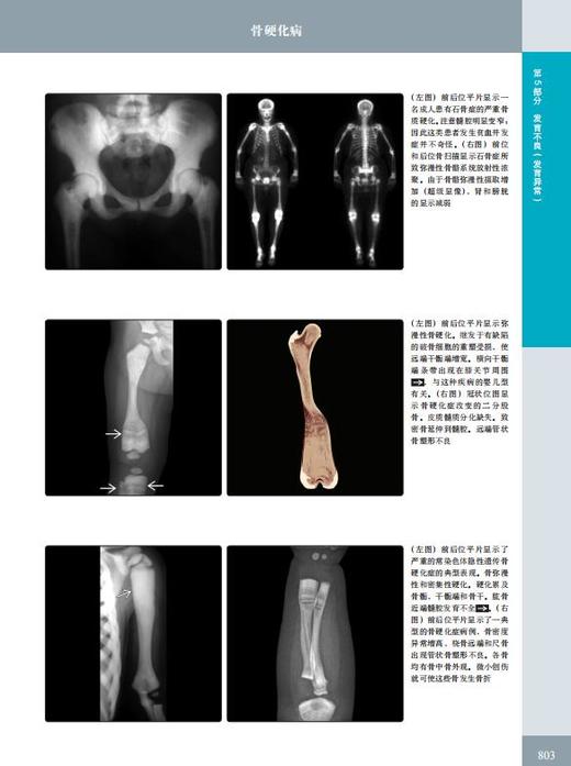 《骨肌影像诊断学（非创伤性疾病）（原著第 2 版）》——国际经典影像诊断学丛书 商品图2