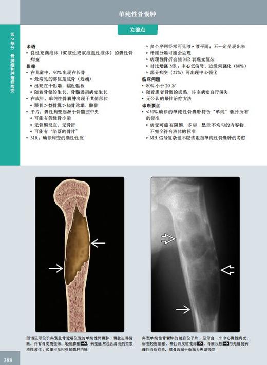 《骨肌影像诊断学（非创伤性疾病）（原著第 2 版）》——国际经典影像诊断学丛书 商品图1