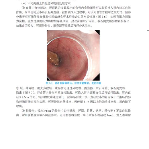 【签名版】实用急诊消化内镜技术 商品图3