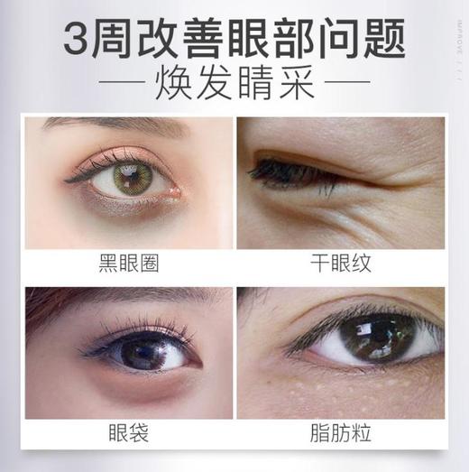 【眼贴】。笛爱儿黑珍珠眼膜贴改善黑眼圈眼袋细纹补水眼贴 商品图2