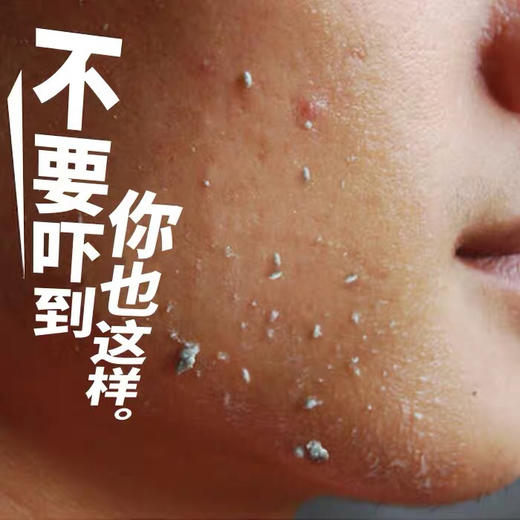太极古芳 肌底赋活去角质素啫喱60g    手足脸部身体补水死皮黑头 商品图3