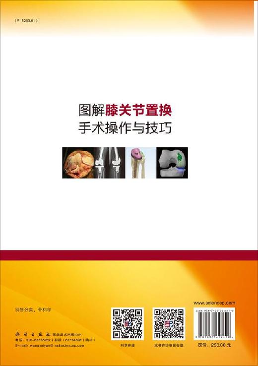 图解膝关节置换手术操作与技巧/王坤正 商品图1