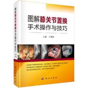 图解膝关节置换手术操作与技巧/王坤正
