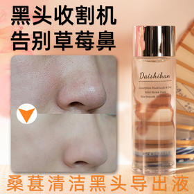 一抹，黑头全无！【桑葚清洁黑头导出液】黑头自动导出 黑头收割机 日本配方 告别草莓鼻 细腻光滑