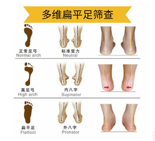 多维扁平足筛查项目 商品图2