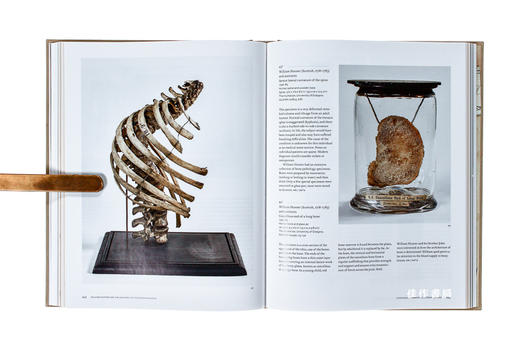 William Hunter and the Anatomy of the Modern Museum / 威廉·亨特和现代博物馆的解剖学 商品图3