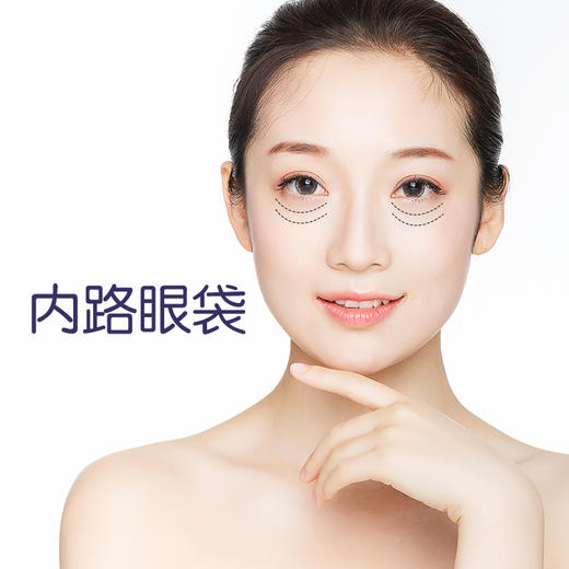 内路去眼袋术 消除眼周松弛 焕发睛彩 商品图0