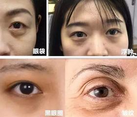 甩掉眼纹、眼袋、黑眼圈，教你一双“眼”拯救全脸！