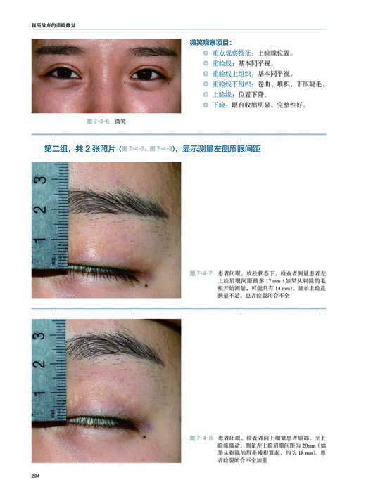 19年9月新书《我所放弃的重睑修复》张诚 田怡 著 商品图4