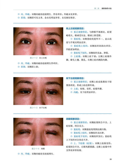 19年9月新书《我所放弃的重睑修复》张诚 田怡 著 商品图1