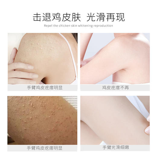 【特惠】木瓜蛋白酶去鸡皮精华乳——让肌肤更丝滑 商品图1