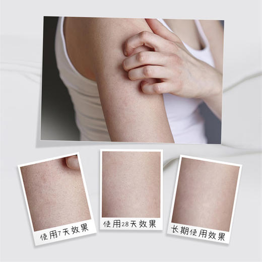 【特惠】木瓜蛋白酶去鸡皮精华乳——让肌肤更丝滑 商品图3
