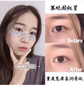 甩掉黑眼圈，熬夜不留痕！