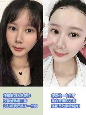 秋冬美白大作战！两周白成反光板💕